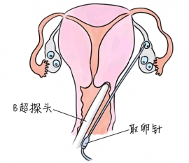 幼儿学画画，乌鲁木齐捐卵宝宝学画画，学画画的好处，如何学画画