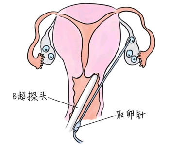 幼儿学画画，乌鲁木齐捐卵宝宝学画画，学画画的好处，如何学画画